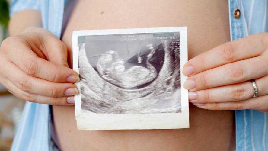 Tackling Maternal Mortality